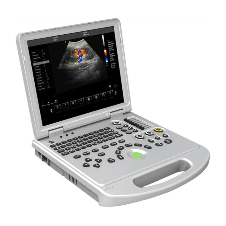 4D Color Ultraound Cardiac Scanner