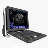 ラップトップ超音波診断システム
