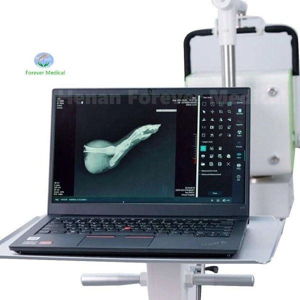 digital x-ray flat panel detector